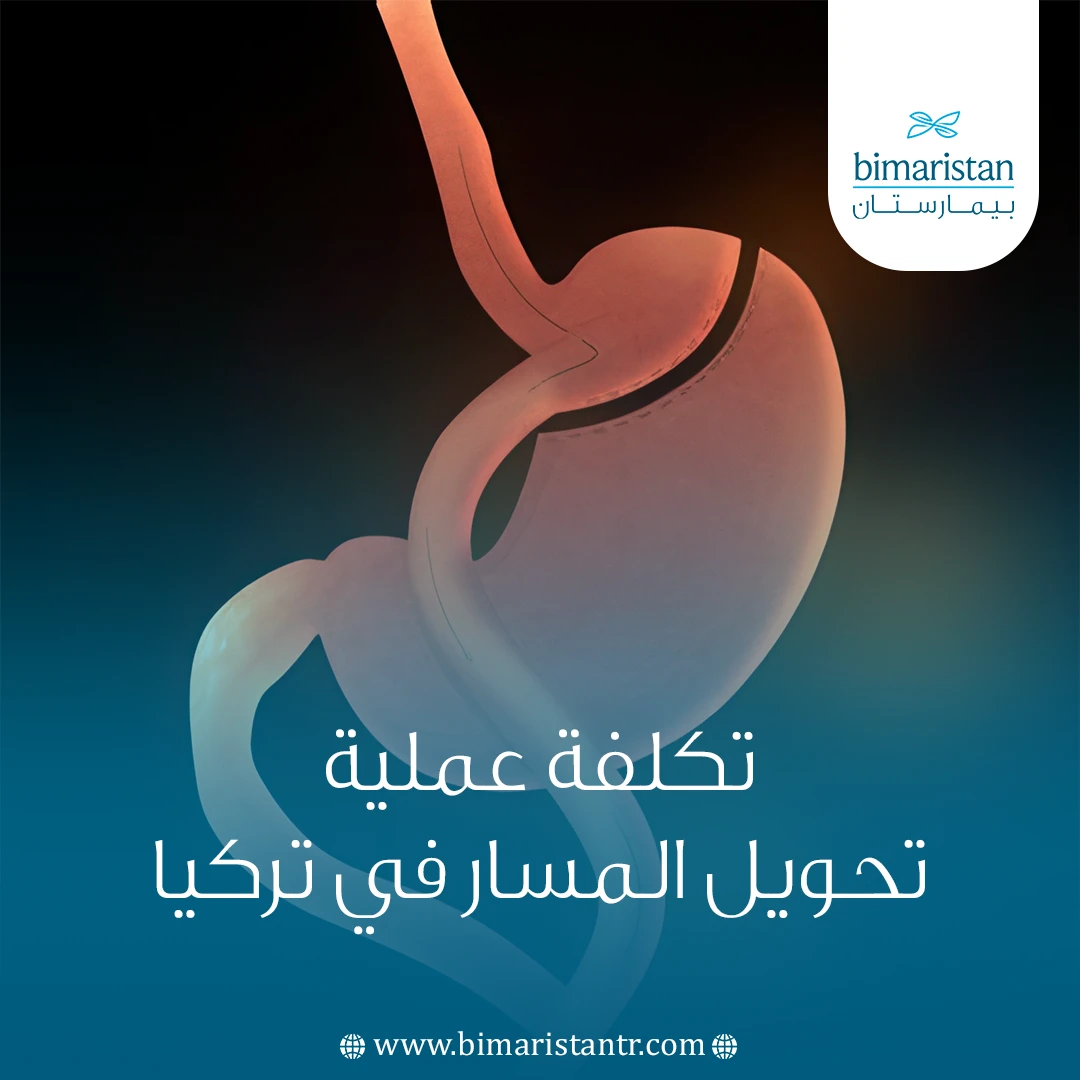 تكلفة عملية تحويل المسار في تركيا: الدليل الشامل 2025