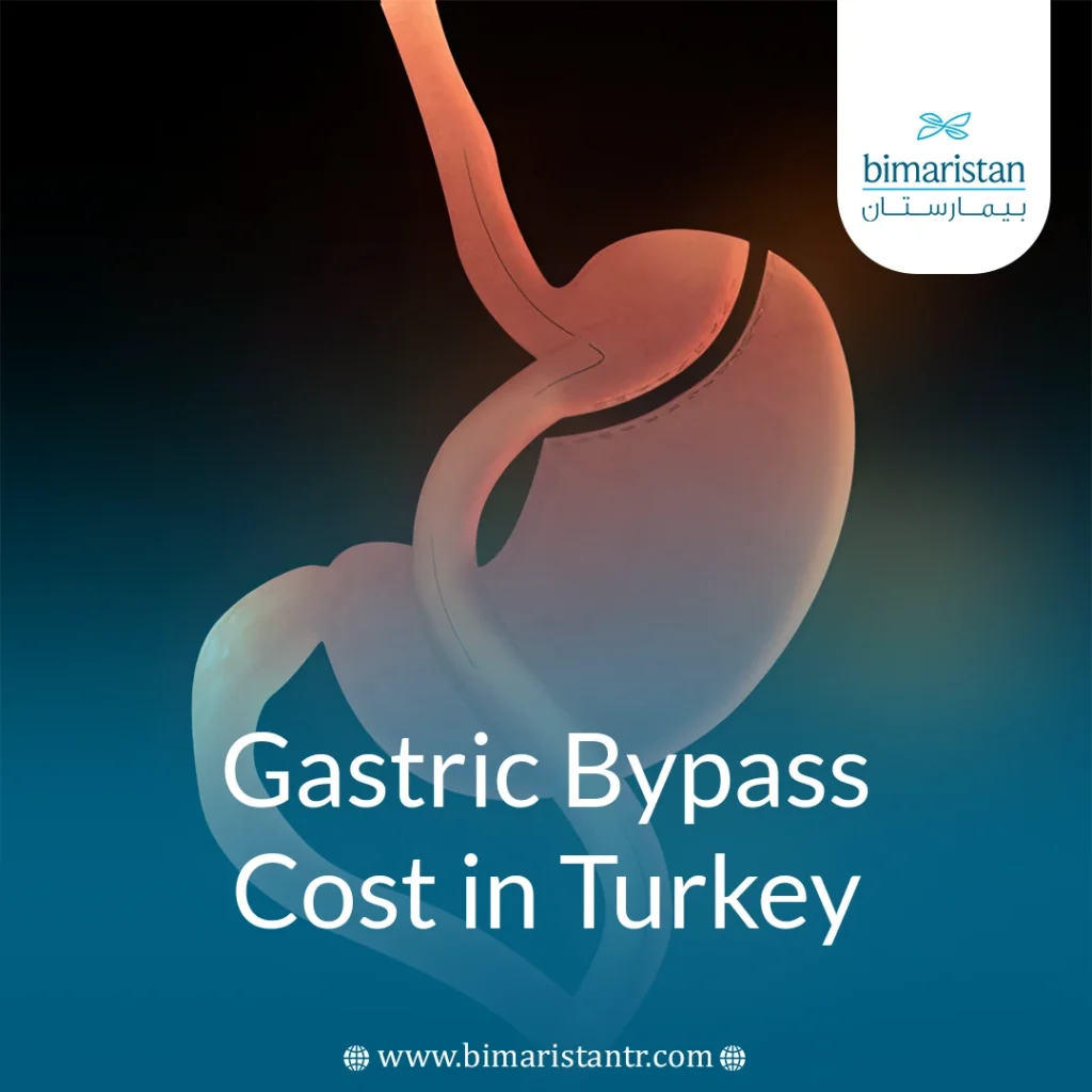 Gastric Bypass Cost In Turkey