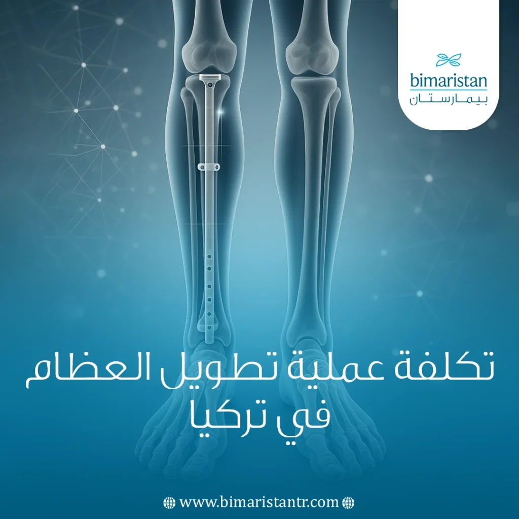 تكلفة عملية تطويل العظام في تركيا