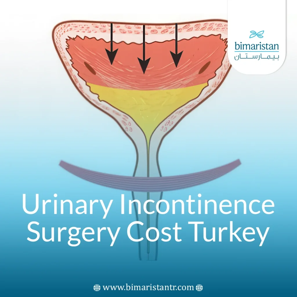 Urinary Incontinence Surgery Cost In Turkey: Quality &Amp; Price