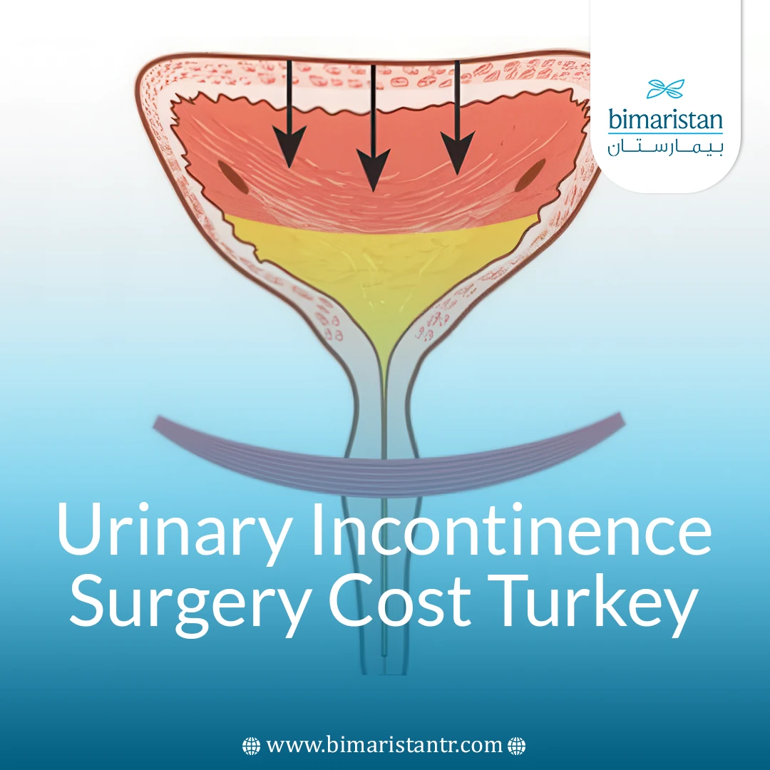 Surgical Urinary Incontinence Surgery Cost In Turkey 2025: Surprising Quality And Prices