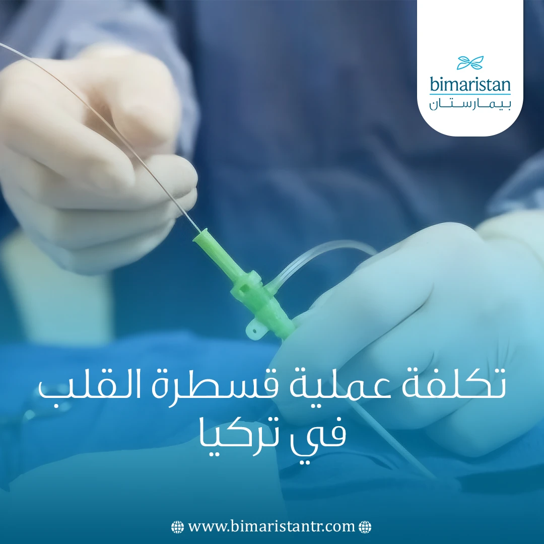تكلفة عملية قسطرة القلب في تركيا