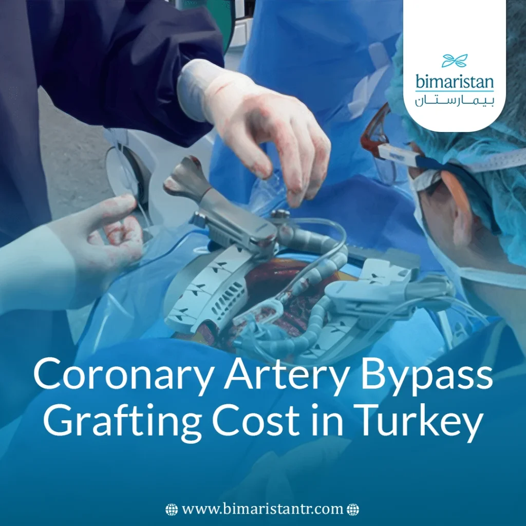 Coronary Artery Bypass Grafting Cost In Turkey