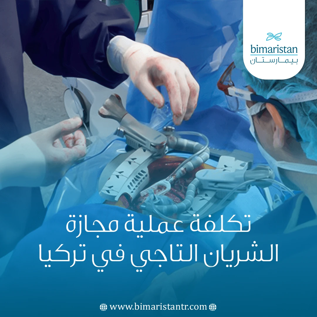 تكلفة عملية مجازة الشريان التاجي في تركيا