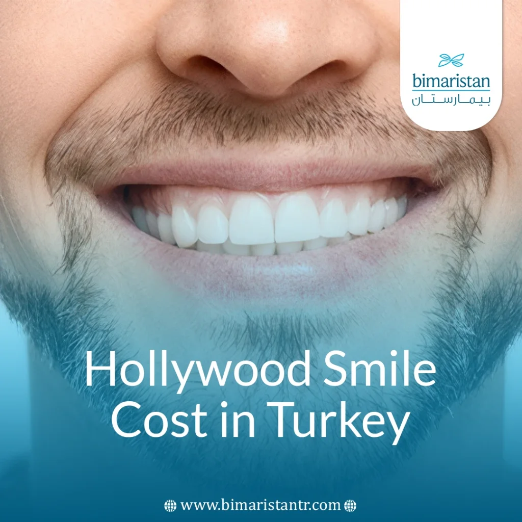 Hollywood Smile Cost In Turkey