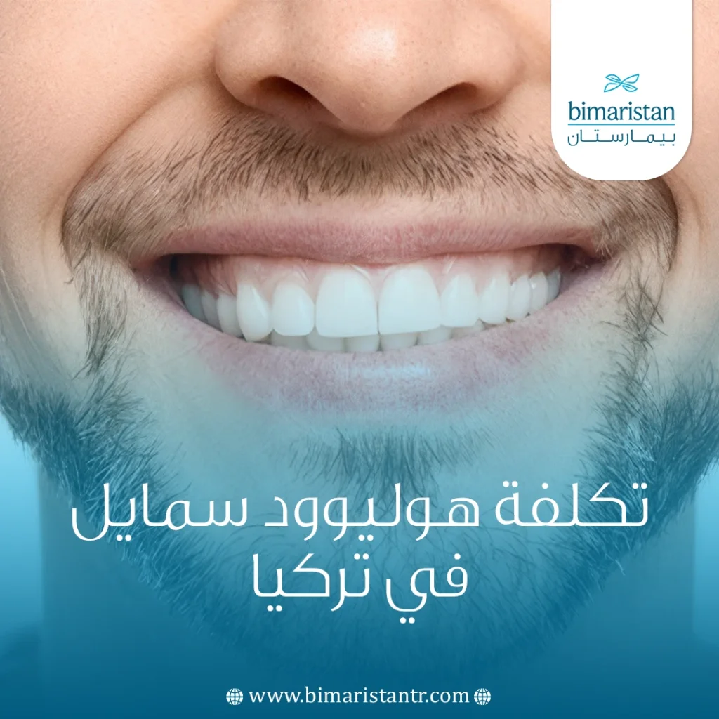 تكلفة هوليوود سمايل في تركيا