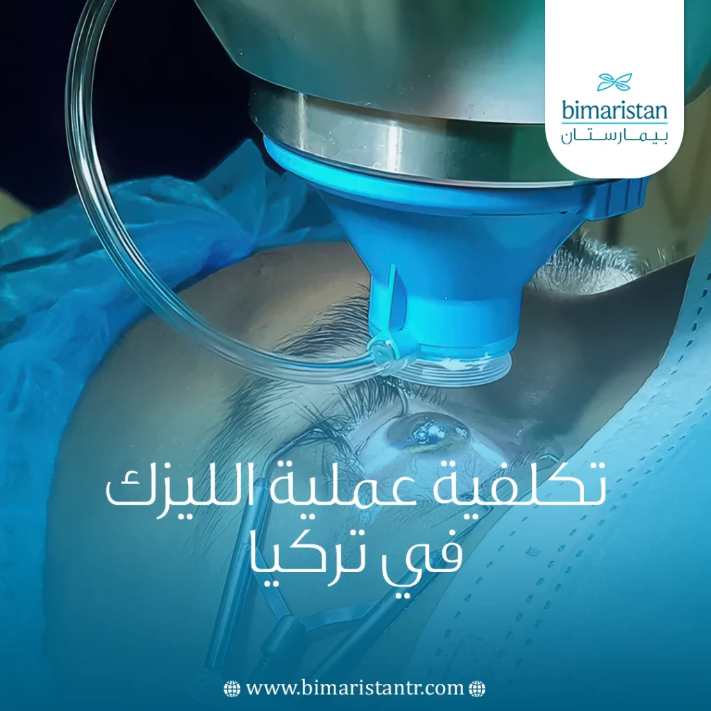 تكلفية عملية الليزك في تركيا