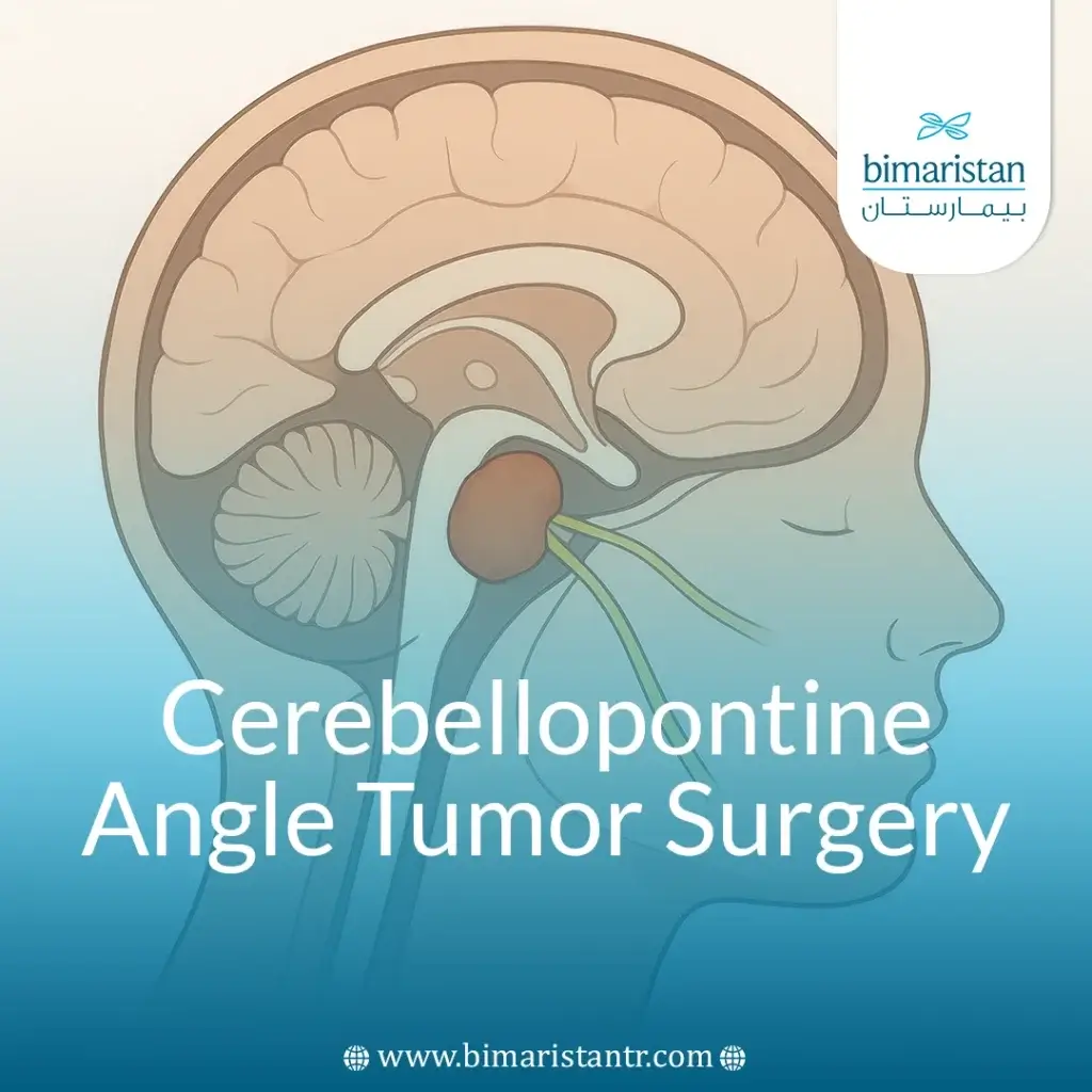 Cerebellopontine Angle Tumor Surgery: When &Amp; Why?
