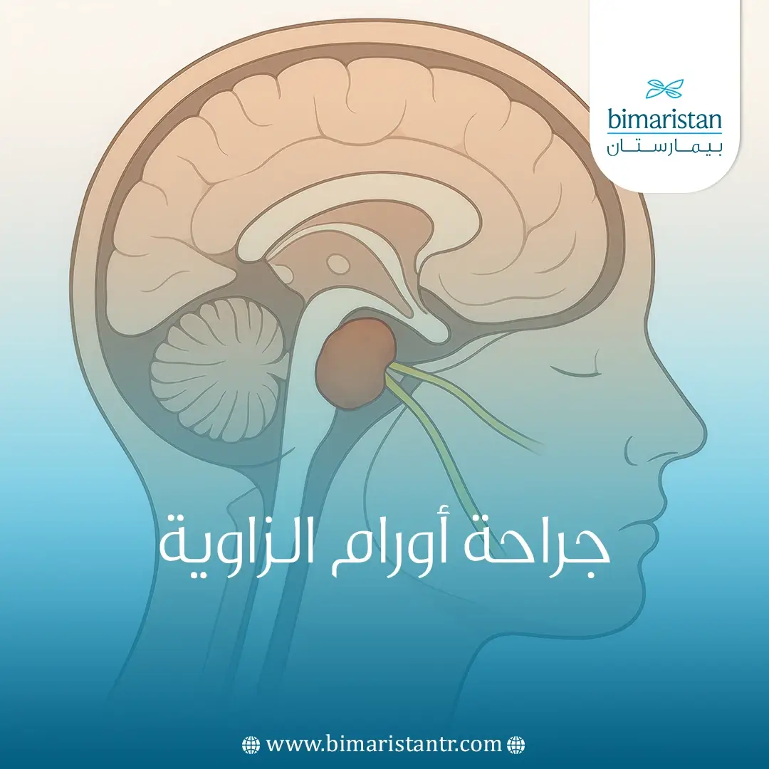 جراحة أورام الزاوية