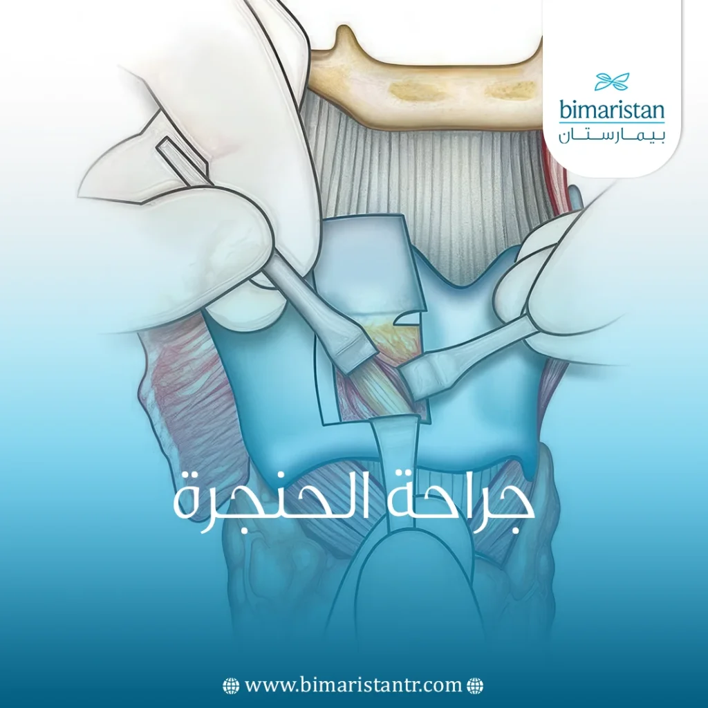 جراحة الحنجرة