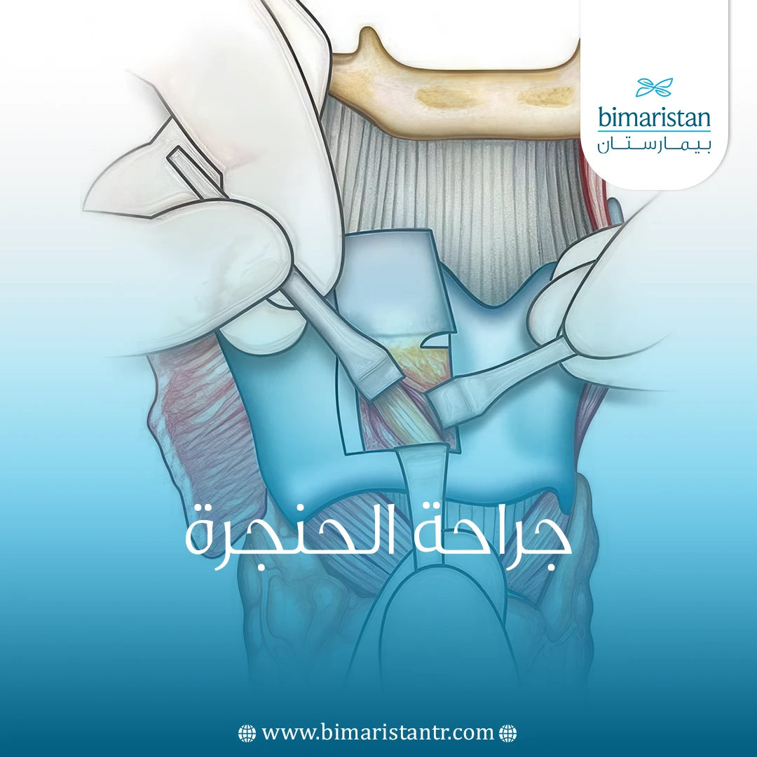 جراحة الحنجرة