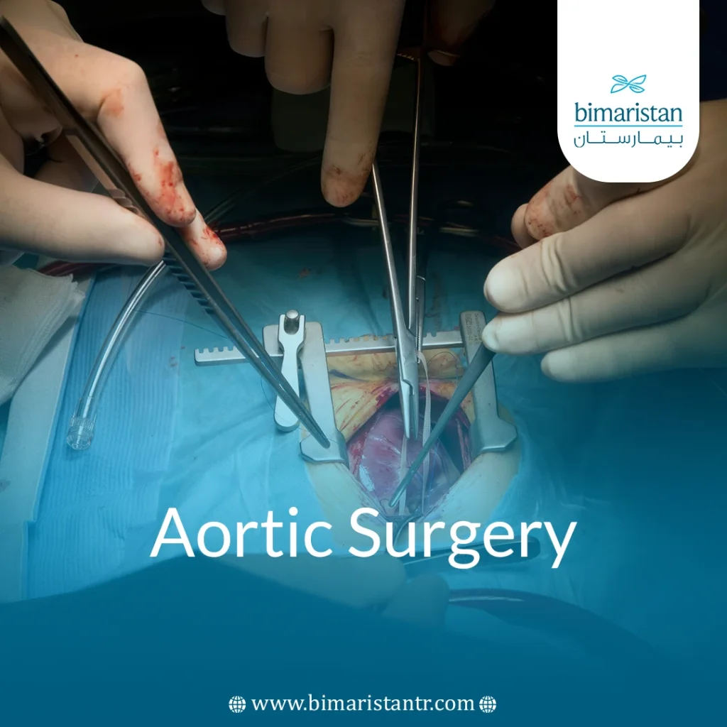 Aortic Surgery: Guide From Diagnosis To Full Recovery