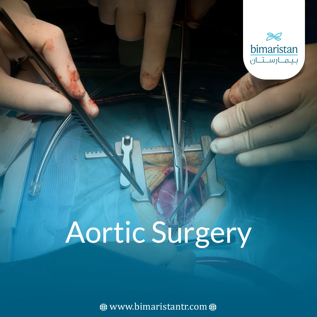Aortic Surgery: Guide From Diagnosis To Full Recovery