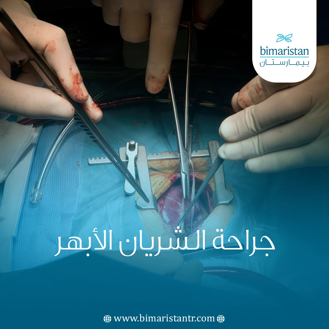 جراحة الشريان الأبهر