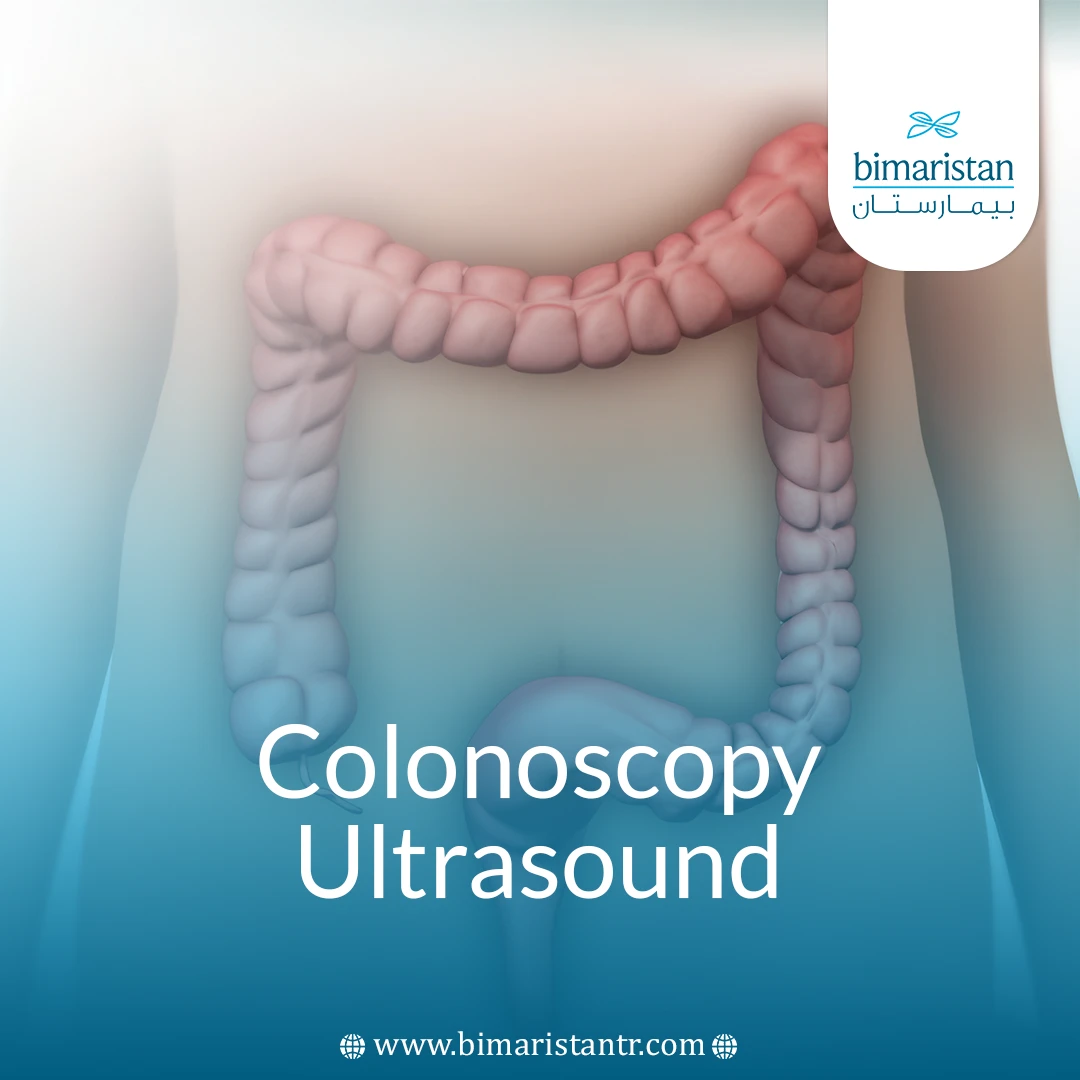 Colonscopic Ultrasound Procedure