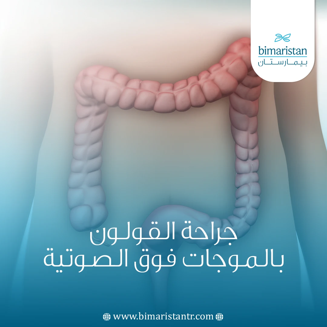 جراحة القولون بالموجات فوق الصوتية