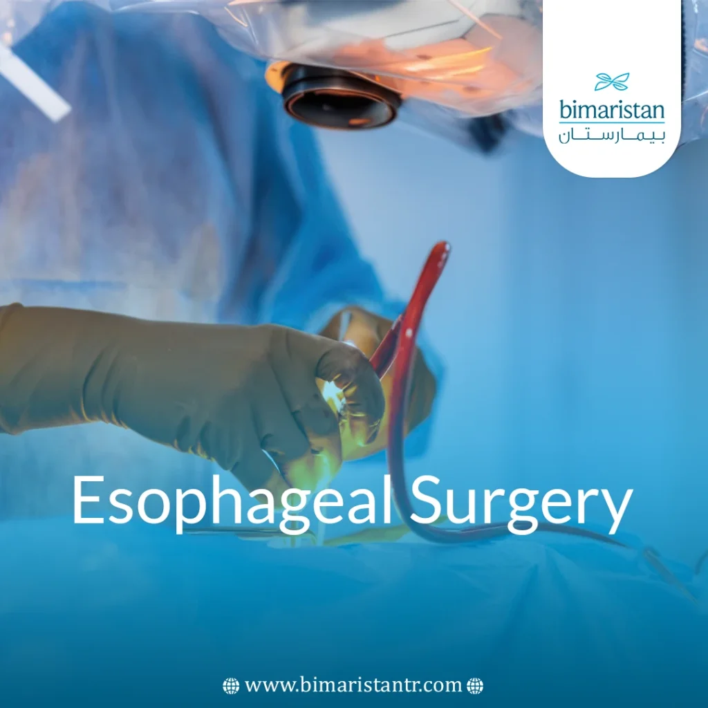Esophageal Surgery: Indications, Procedure &Amp; Success Rates
