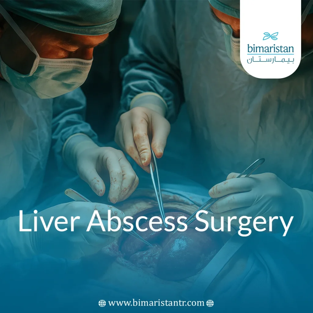 Liver Abscess Surgery: Indications &Amp; Best Treatment Options