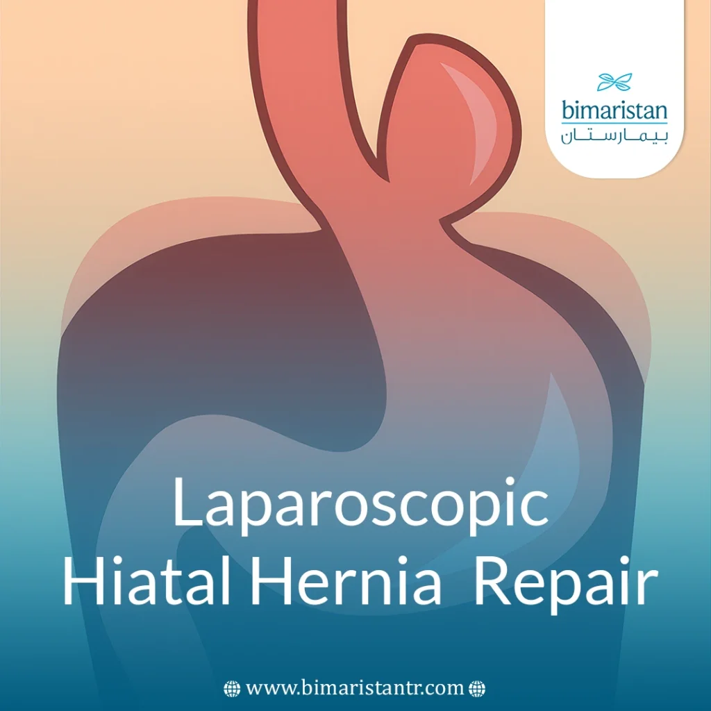 Laparoscopic Hiatal Hernia Repair