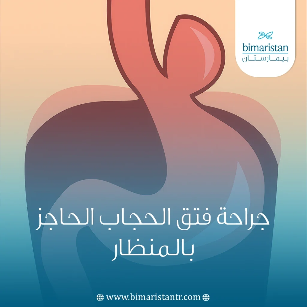 جراحة فتق الحجاب الحاجز بالمنظار