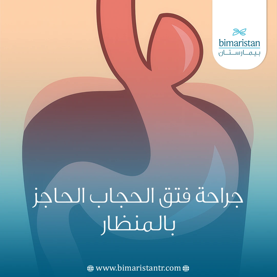 جراحة فتق الحجاب الحاجز بالمنظار
