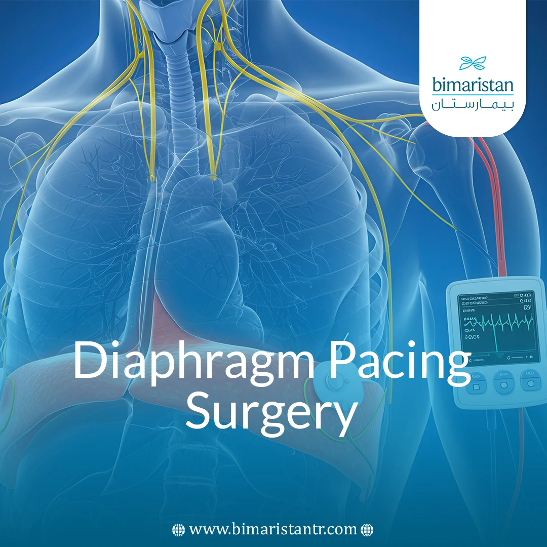 Diaphragm Pacing Surgery