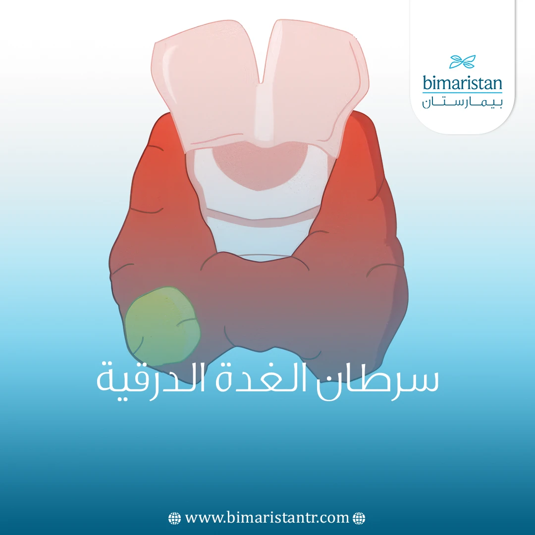 سرطان الغدة الدرقية