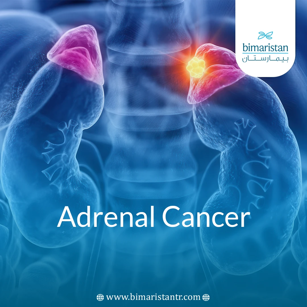 Adrenal Cancer: Your Path To Recovery