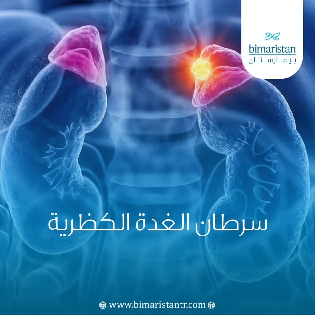 سرطان الغدة الكظرية