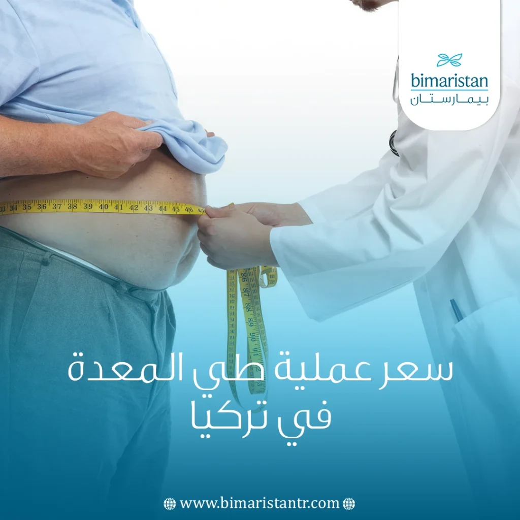 سعر عملية طي المعدة في تركيا