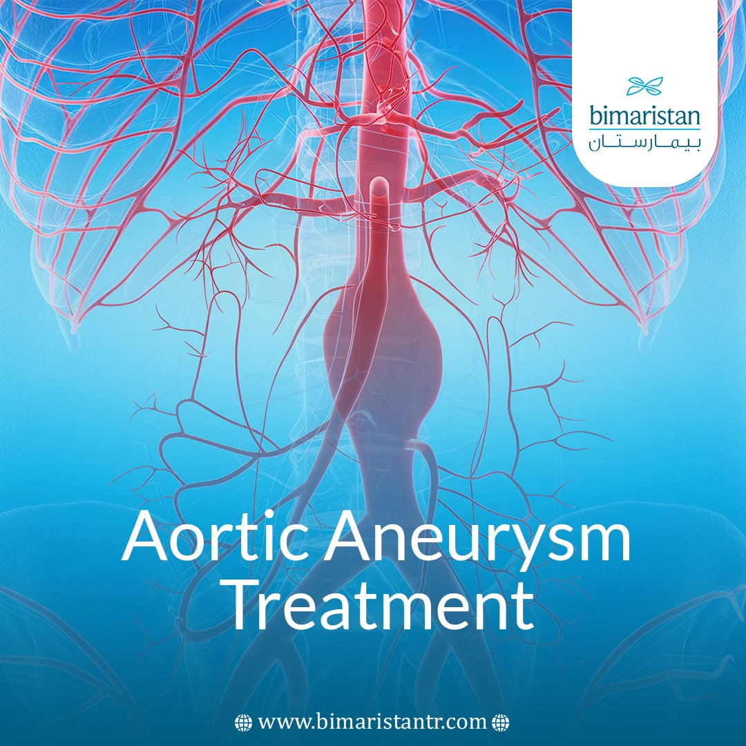 Aortic Aneurysm Treatment