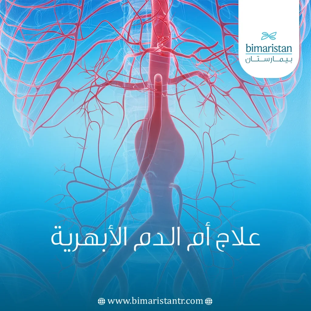 علاج أم الدم الأبهرية