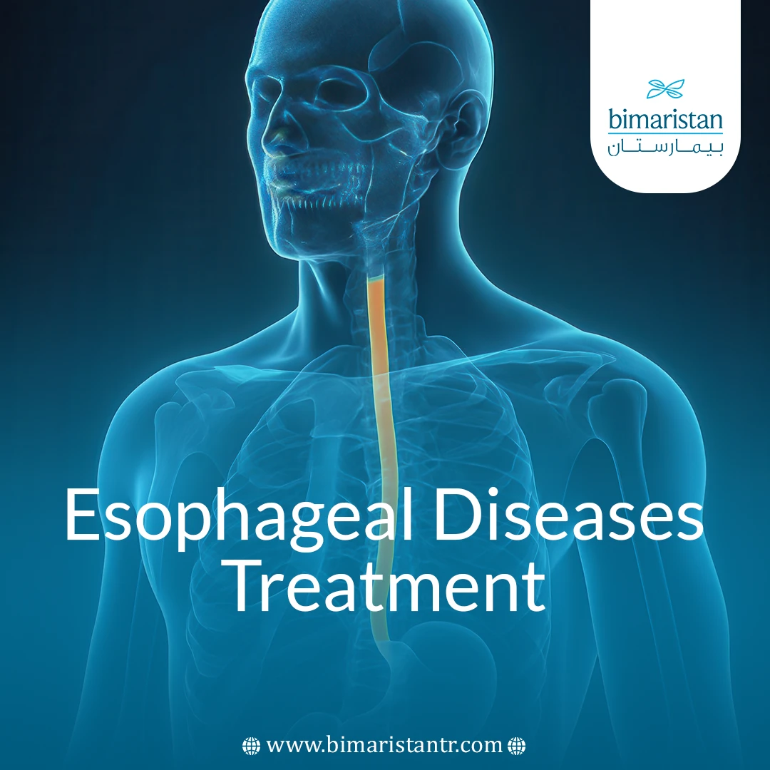 Esophagus Disease Treatment: Latest Medical &Amp;Amp; Surgical Care