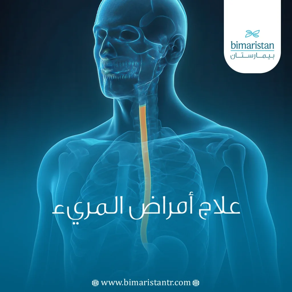 علاج أمراض المريء