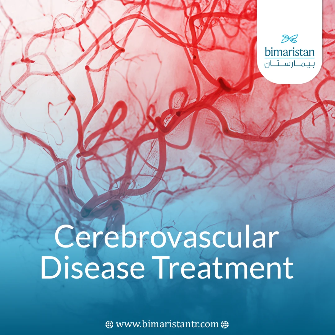 Cerebrovascular Disease Treatment