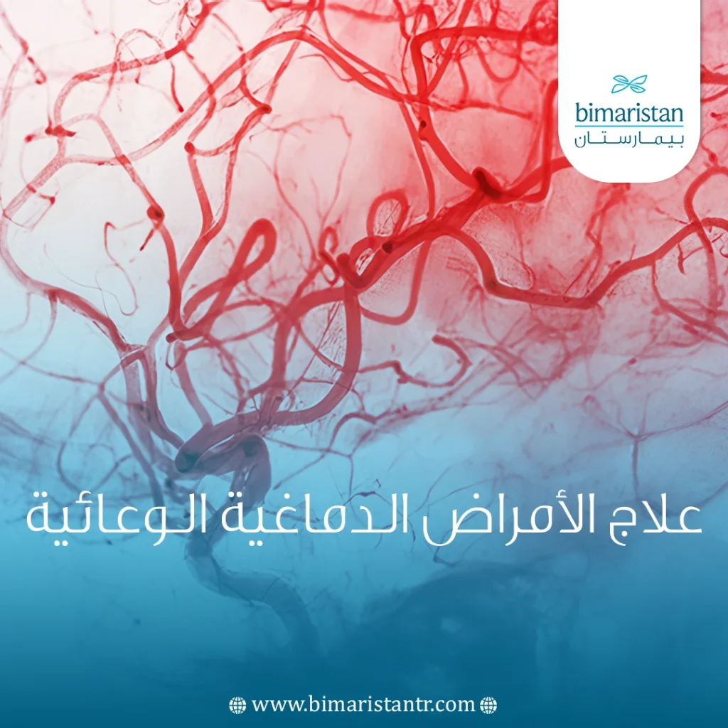 علاج الأمراض الدماغية الوعائية