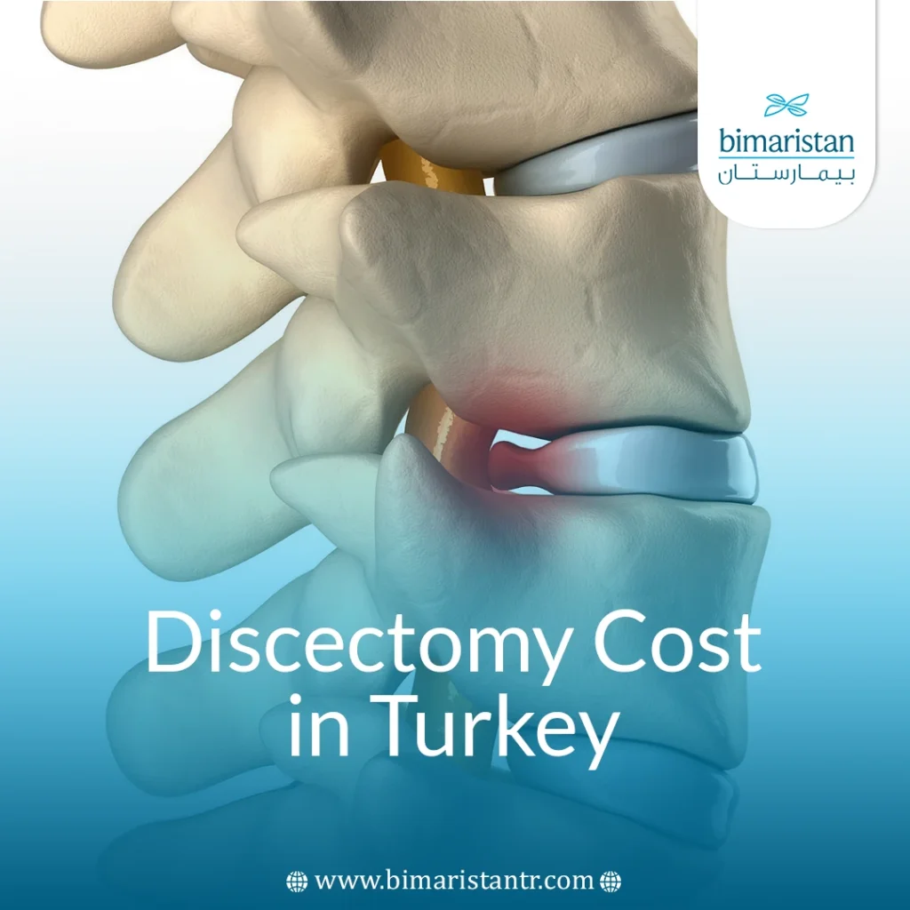 Discectomy Cost In Turkey