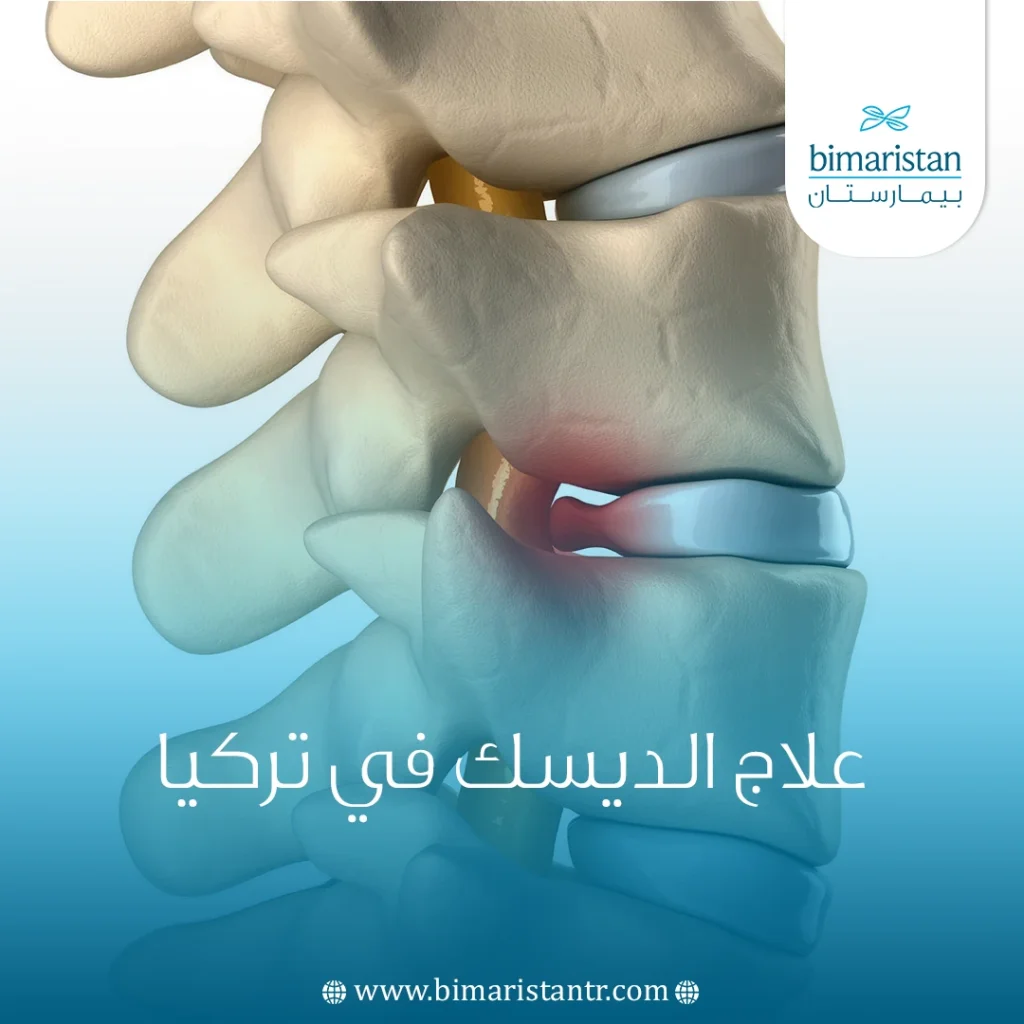 علاج الديسك في تركيا