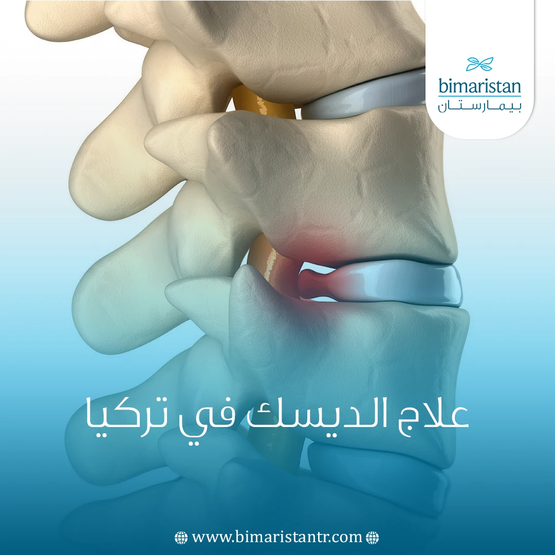 علاج الديسك في تركيا