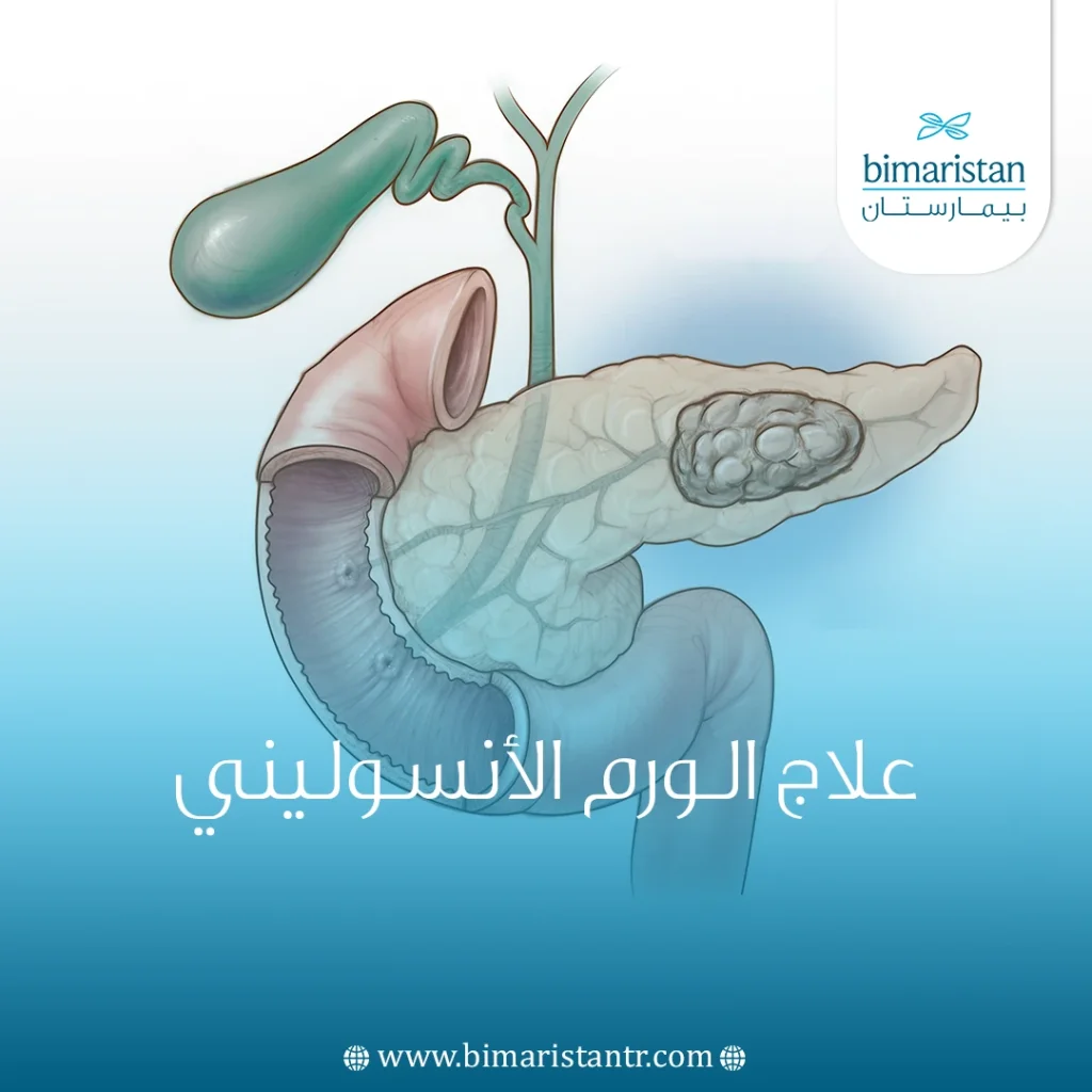 علاج الورم الأنسوليني