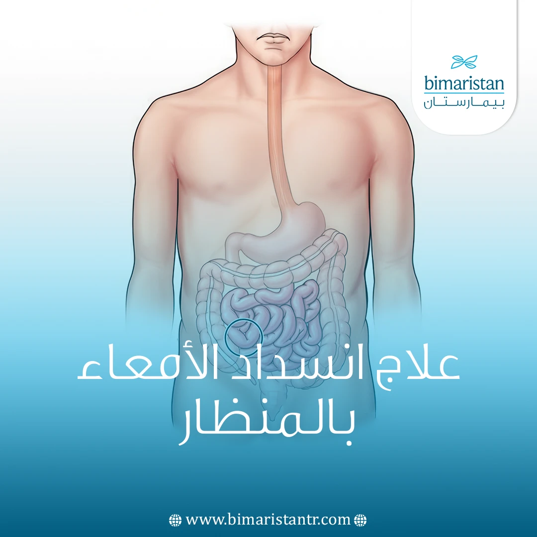 علاج انسداد الأمعاء بالمنظار