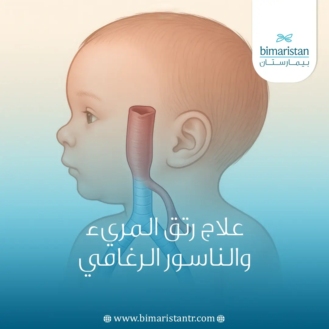 علاج رتق المريء والناسور الرغامي