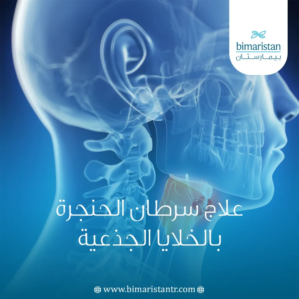 علاج سرطان الحنجرة بالخلايا الجذعية