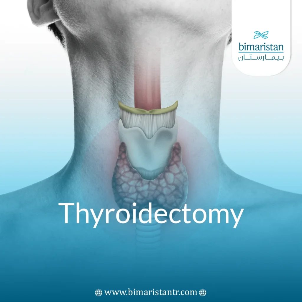 Thyroidectomy: Procedure, Risks, Recovery, And What You Need To Know