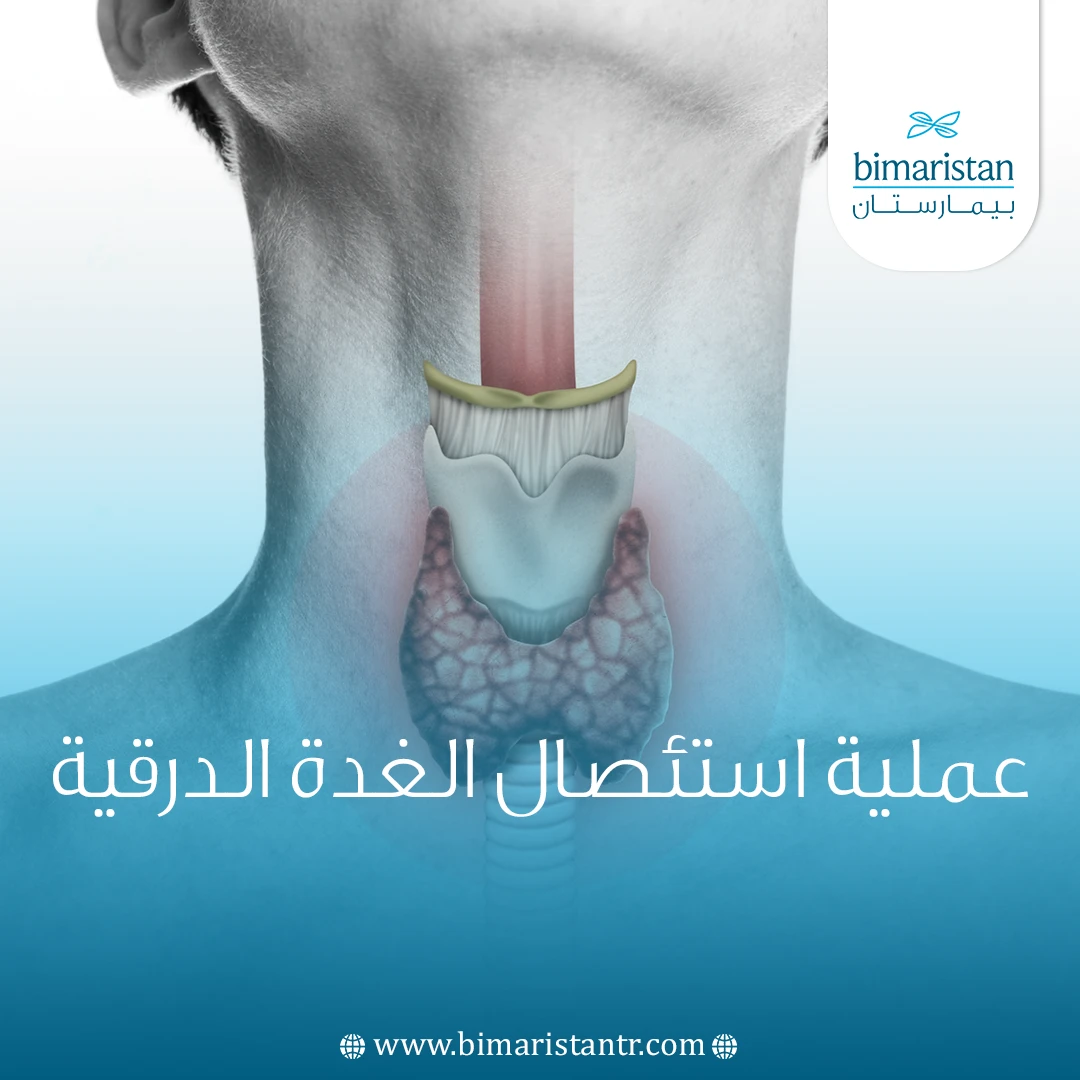 عملية استئصال الغدة الدرقية