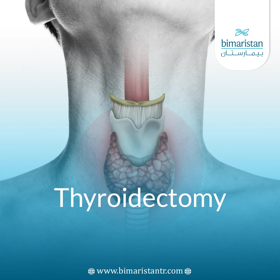 Thyroidectomy: Procedure, Risks, Recovery, And What You Need To Know