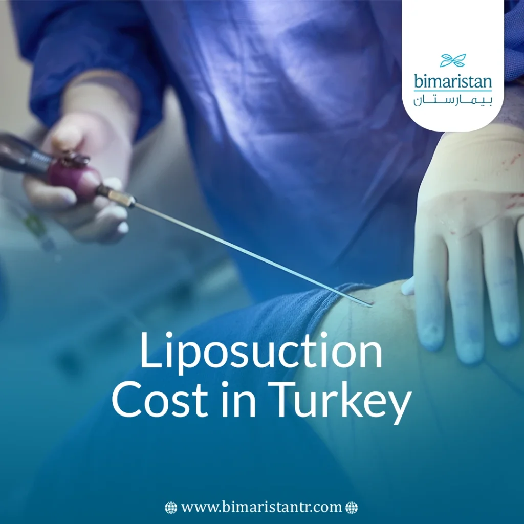 Liposuction Cost In Turkey