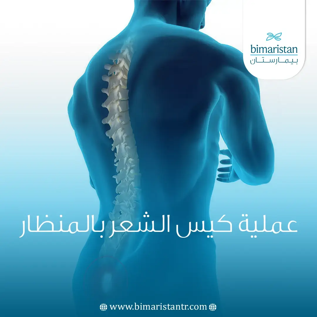 عملية كيس الشعر بالمنظار