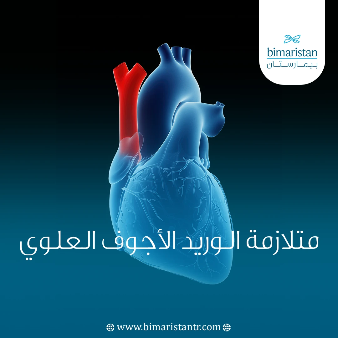 متلازمة الوريد الأجوف العلوي
