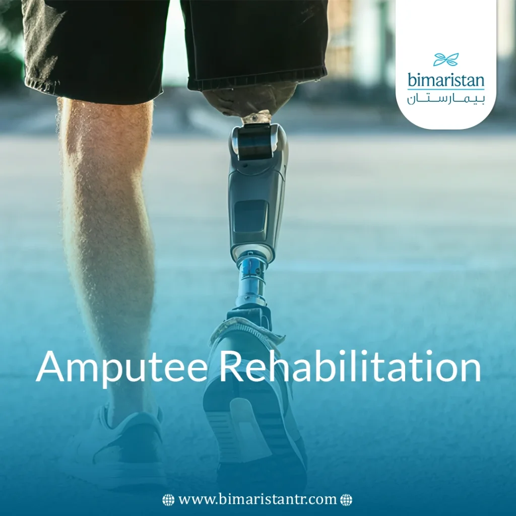 Amputee Rehabilitation: From First Visit To Full Recovery